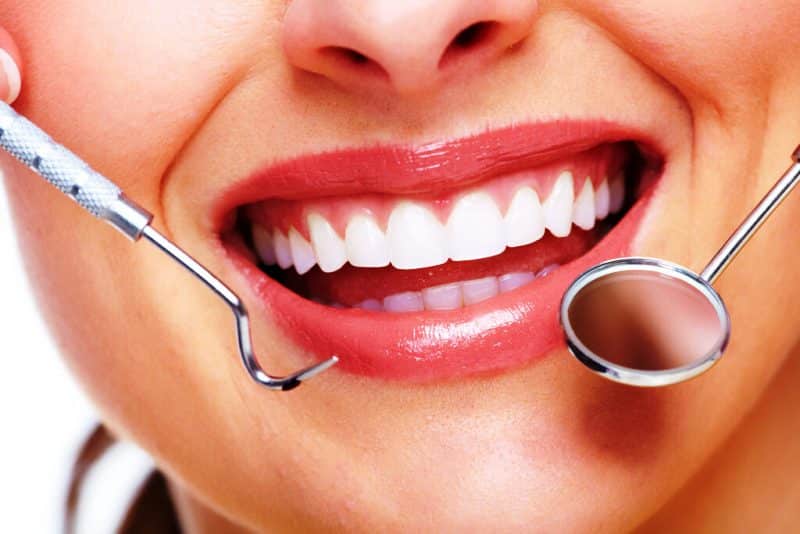 Teeth Whitening service